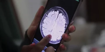 La IA detecta cáncer de mama 5 años antes de los síntomas, afirma José Joaquín Puello