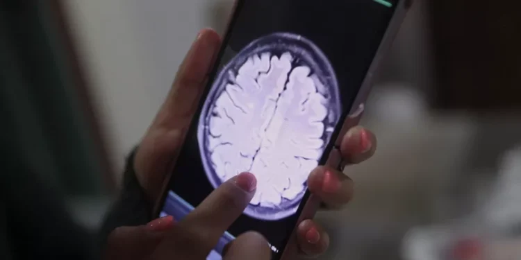 La IA detecta cáncer de mama 5 años antes de los síntomas, afirma José Joaquín Puello