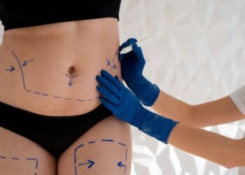 ¿Es seguro realizarse varios procedimientos estéticos en una sola cirugía?