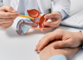 6 señales tempranas de cáncer de próstata que los hombres no reconocen