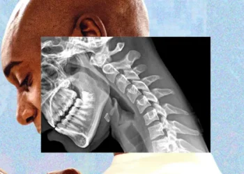 «Cuerpo de teléfono»: cómo la tecnología nos arruga el cuello y debilita las manos