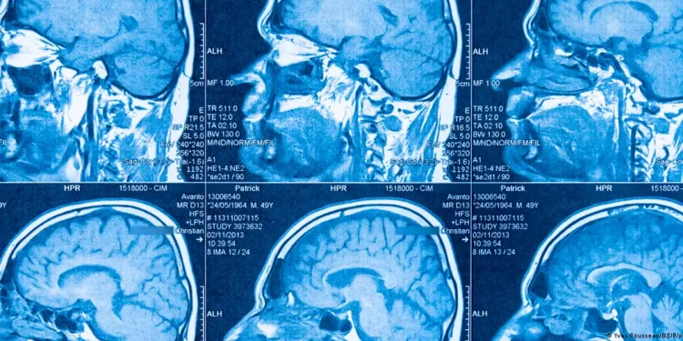 El cerebro humano no es uno, sino dos órganos