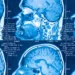 El cerebro humano no es uno, sino dos órganos