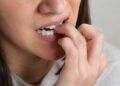 Morderse las uñas puede desgastar los dientes y alterar la mordida
